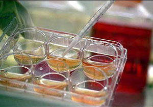 درمان 60 نوع بیماری صعب‌العلاج با سلول‌های بنیادی