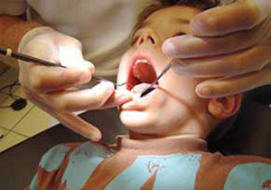 اختلالات اسکلتی عضلانی بیماری شایع دندانپزشکان مرد است