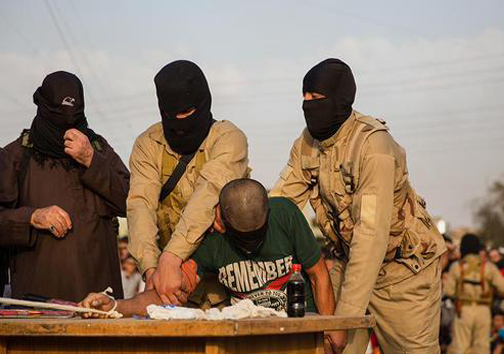 قطع دست شهروند عراقی توسط داعش+تصاویر