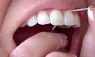 عدم رعایت بهداشت دهان و دندان، یک عامل بروز سرطان غدد بزاقی