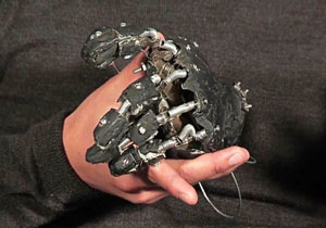 این دست مصنوعی برق تولید می‌کند