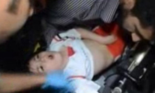 آسیب دیدگی دست کودک 5 ساله در پله برقی + فیلم