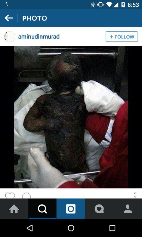 آخرین تصاویر از نوزادی که صهیونیست ها زنده سوزاندند!(18+)