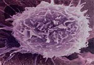 روش جدید دانشمندان برای آسیب پذیری سلول های سرطانی