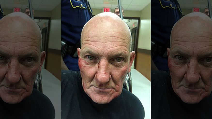 زخمی‌ شدن یک افسر پلیس آمریکا بر اثر تیراندازی + تصویر