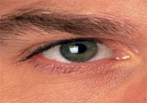 ویژن‌تراپی درمانی‌نو برای درمان اختلال چشمی