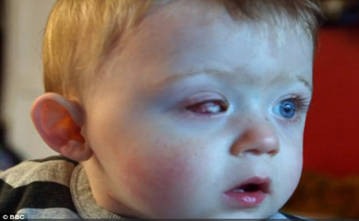 هدیه تولد چشم کودک را کور کرد+ تصاویر
