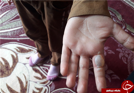 تنبیه بدنی دانش‌آموز چاروسایی توسط معلم +عکس
