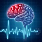 زنگ خطر سکته مغزی در کشور به صدا در آمده/ راه‌اندازی واحدهای ویژه سکته مغزی در بیمارستان‌های سراسر کشور