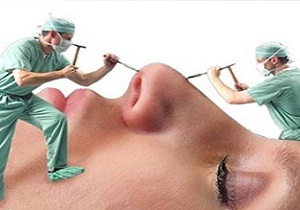 انواع عوارض جراحی بینی