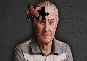 ۱۰ حقیقت شگفت انگیز در مورد بیماری آلزایمر