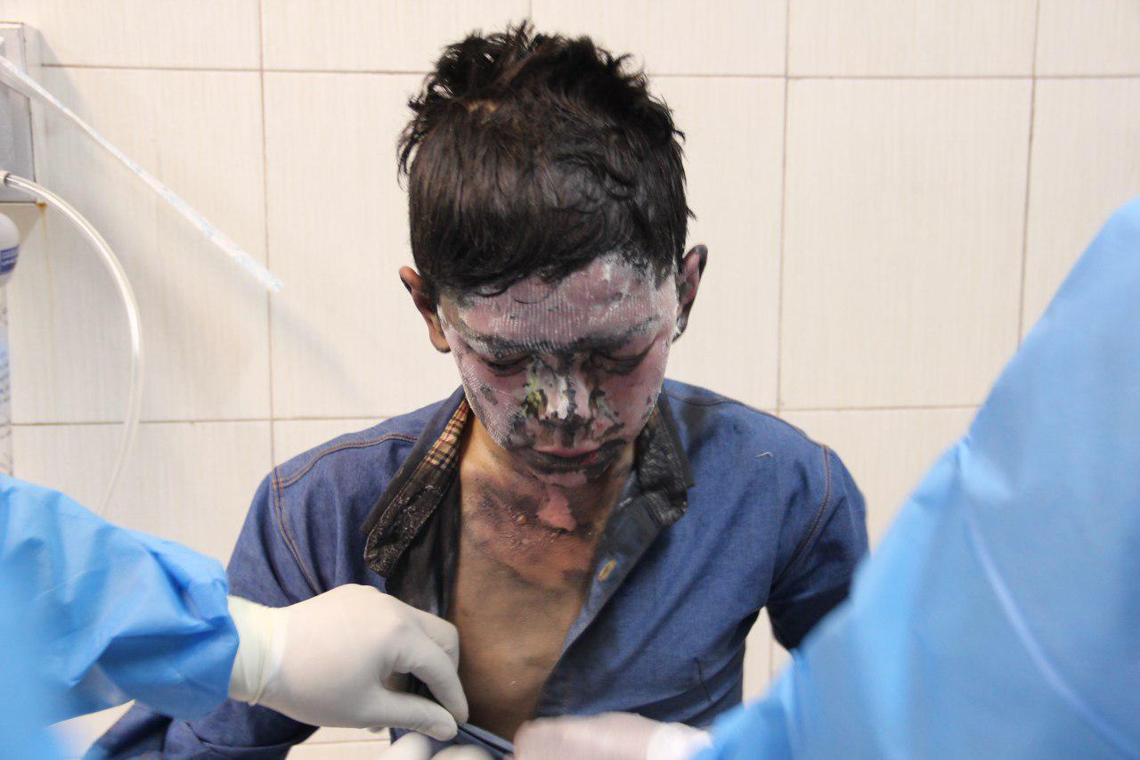 تصاویری وحشتناک با طعم درد و خون از چهارشنبه سوری سال ۹۴/ صورت هایی که با ترقه نابود شدند