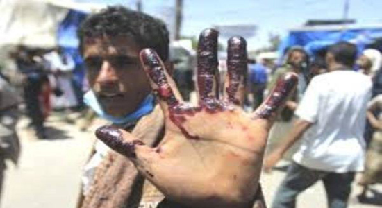 چرا عربستان در باتلاق یمن دست و پا می‌زند؟ + تصاویر