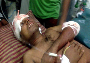 مظنون حمله به یک معلم ریاضی در بنگلادش، حین بازداشت کشته شد+تصاویر