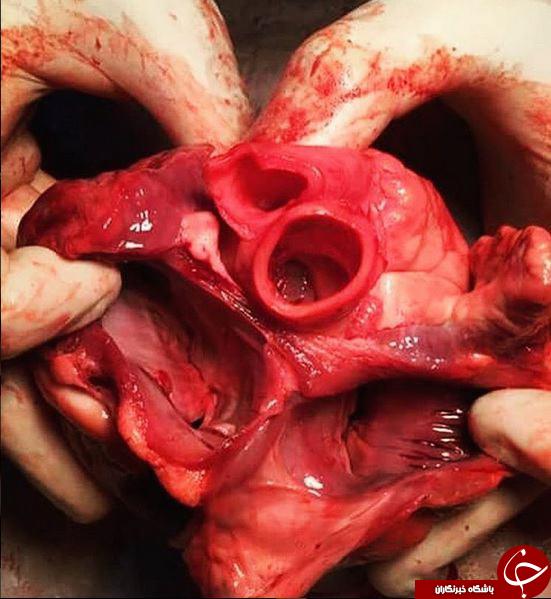 قلب بعد از مردن چه شکلی است؟+ تصاویر