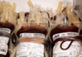 اهدای بیش از 17هزار واحد خون از ابتدای سال جاری
