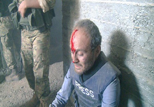 حمله تروریست‌ها به خبرنگار حین تهیه گزارش در حلب + فیلم
