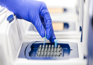 افزایش 33 درصدی آزمایشات PCR