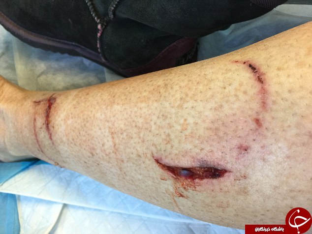 تصاویری وحشتناک از حمله یک وامبت به یک زن و سگهایش+ (6 عکس)