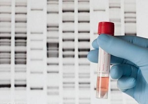 سازمان های بیمه‌گر وظیفه‌ای در قبال حمایت از آزمایش‌های ژنتیک ندارند