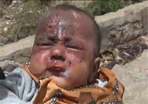 آخرین آمار جنایت سعودی‌ها در یمن/ ۱۰ هزار شهید و ۱۸ هزار زخمی
