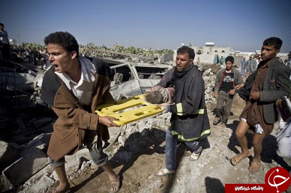 یا بمب‌های عربستان یمنی‌ها را می‌کشد یا گرسنگی!
