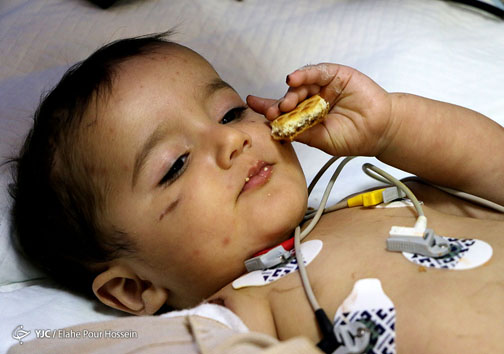 پیوند بازوی قطع شده کودک 13 ماهه اهوازی در شیراز‎ به روایت تصویر