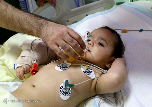 پیوند بازوی قطع شده کودک 13 ماهه اهوازی در شیراز‎ به روایت تصویر