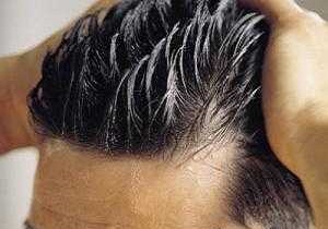 آلودگی هوا خطری برای سلامت موهای سر/ با این راهکار به جنگ چربی مو بروید