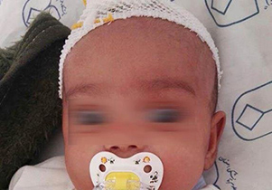 پدری نوزاد سه ماهه خود را ضربه مغزی کرد