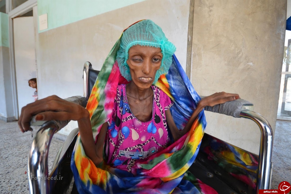 تکان‌دهنده‌ترین تصاویر از جنگ یمن