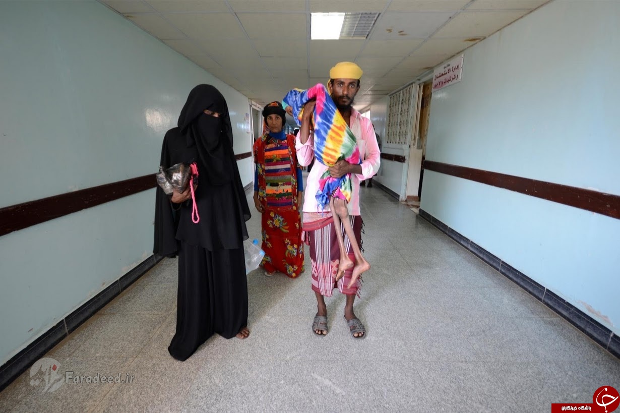 تکان‌دهنده‌ترین تصاویر از جنگ یمن