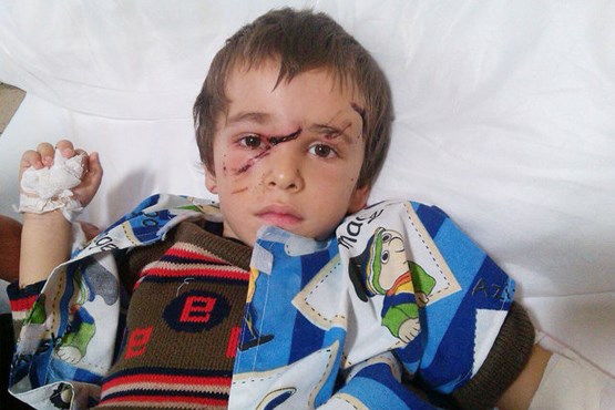 حمله گرگ به کودک 4 ساله +عکس