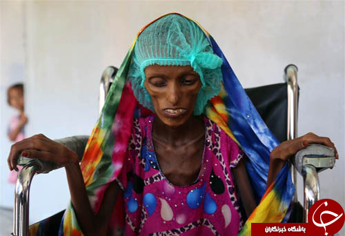 از بیماری تاثر برانگیز زن یمنی تا جشنواره قبایل هندی
