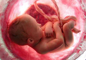 سقط درمانی در لرستان 20درصد افزایش یافته است