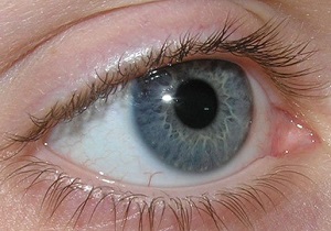 قدم سرطان روی چشم/ با دیدن این علائم در چشم ها باید به سرطان شک کرد!