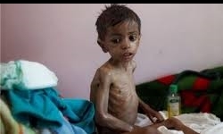 بیش از ۸ میلیون گرسنه در یمن وجود دارد