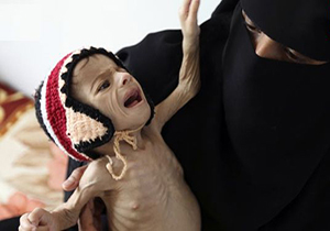ناتوانی سازمان های بشردوستانه برای مقابله با وضعیت فاجعه بار یمن