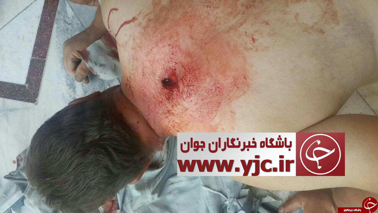 اولین تصاویر از مجروحین تیراندازی صبح امروز مجلس