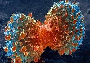 آشنایی با انواع شیوه‌های نوین ایمونوتراپی/ موفقیت چشم‌گیر شرکت دانش بنیان ایرانی در تولید داروی سرطان سینه