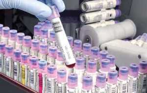 ذخیره سازی حدود 98 هزار نمونه خون بند ناف در کشور