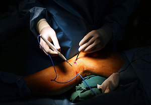 ۱۶ جراحی نوین قلب با حضور ۱۷ متخصص جهانی در بیمارستان رضوی مشهد انجام می‌شود