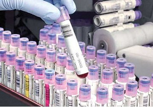 ذخیره‌سازی ۶۵۰ نمونه خون بندناف در بانک خون لرستان