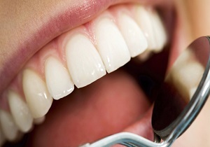 روش‌های ساده خانگی برای سفید کردن دندان‌ها