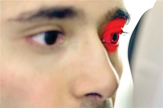 خطرناک ترین بیماری خاموش چشم را بشناسید