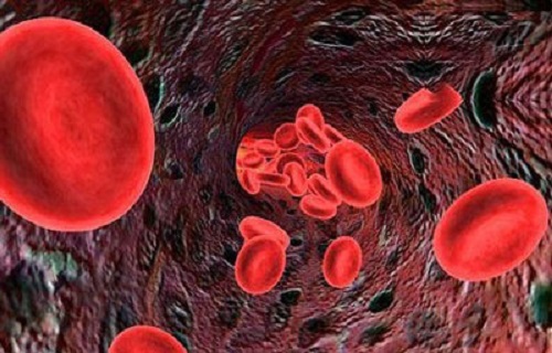بیماری‌های خونی؛ از سرطان خون میلوما چه می‌دانید؟