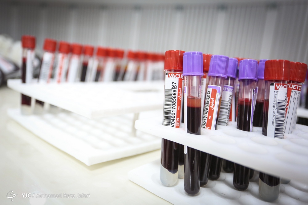 پیشرفت‌های حوزه انتقال خون در چله انقلاب/ از حذف خون فروشی و دلالی تا رشد ۵۰۰ درصدی خون‌های اهدایی