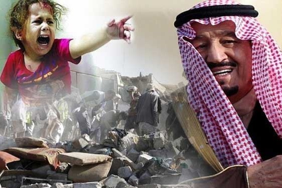 بی رحمی ائتلاف متجاوز سعودی به دوقلو‌های به هم چسبیده یمنی