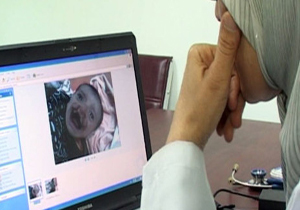 افزایش بیماران سرطانی در عراق به دلیل استفاده آمریکا از اورانیوم ضعیف شده