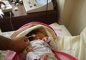 غربالگری شنوایی ۱۹ هزار نوزاد در استان قزوین